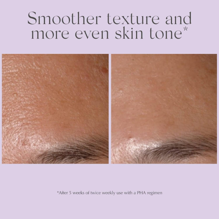 Exuviance Advanced Series Performance Peel AP25