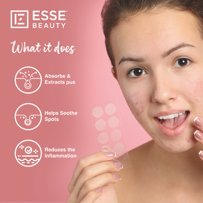 Esse Beauty Trouble Clear Spot Patch 30s