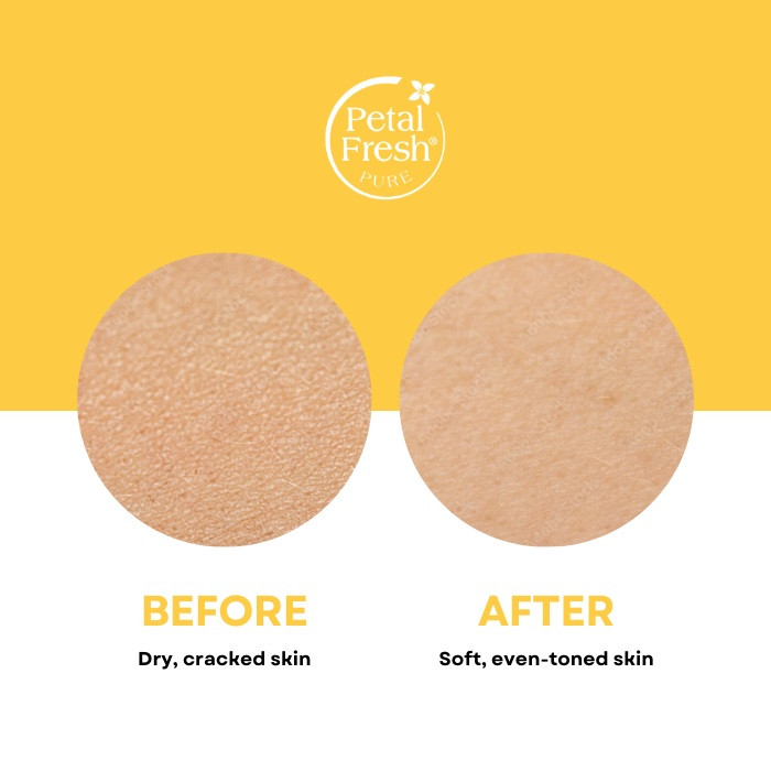 Petal Fresh Pure True Hydration Moisturizer 118ml