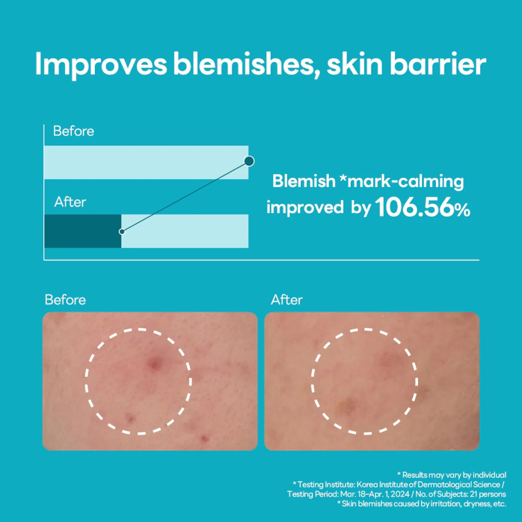 Mediheal Madecassoside Blemish Repair Serum, Brightening and Calming Serum for Post-Acne Marks - 40ml