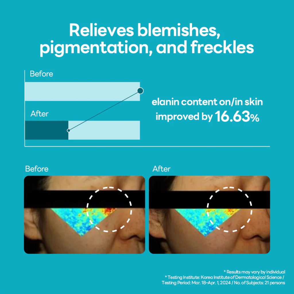 Mediheal Madecassoside Blemish Repair Serum, Brightening and Calming Serum for Post-Acne Marks - 40ml