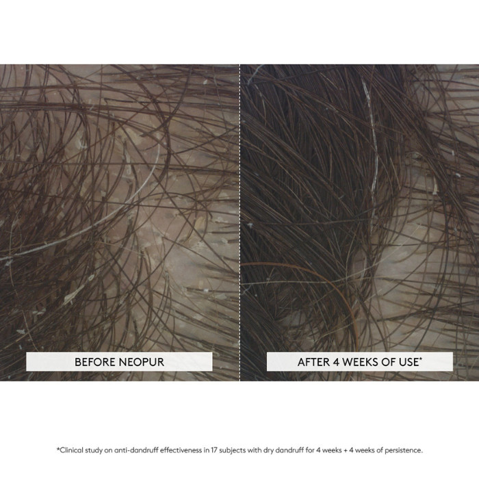 Rene Furterer Neopur Anti-Dandruff Shampoo, Balancing Care for Dry Scalp, Hydrating and Soothing - 250ml