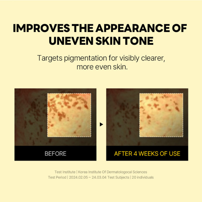 Round Lab Vita Niacinamide Dark Spot Serum - Brightening & Spot-Correcting Serum with Niacinamide & Vitamin C Complex 30ml