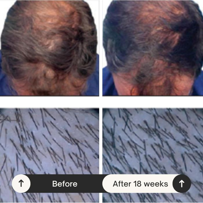 Rausch Caffeine with Ginseng Intensive Scalp Fluid, Hair Loss Treatment and Regrowth Booster, 30ml