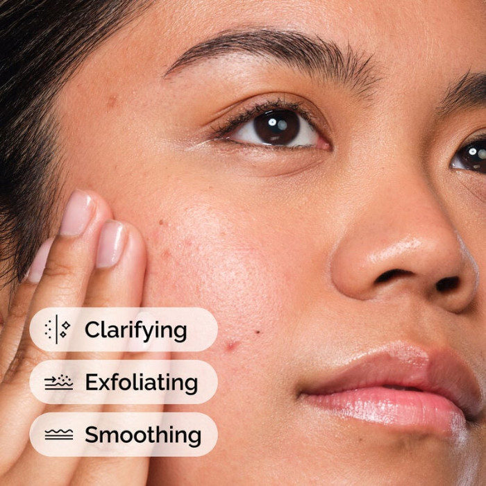 The Ordinary Salicylic Acid 2% Solution, Exfoliating Serum for Blemish-Prone Skin and Pore Care - 30ml