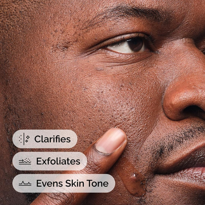 The Ordinary Salicylic Acid 2% Anhydrous Solution, Gentle Blemish Treatment for Clearer, Smoother Skin - 30ml