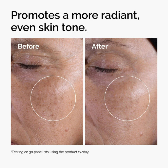 The Ordinary Glycolic Acid 7% Exfoliating Toner, Smooth Skin, Brighten and Even Tone - 100ml