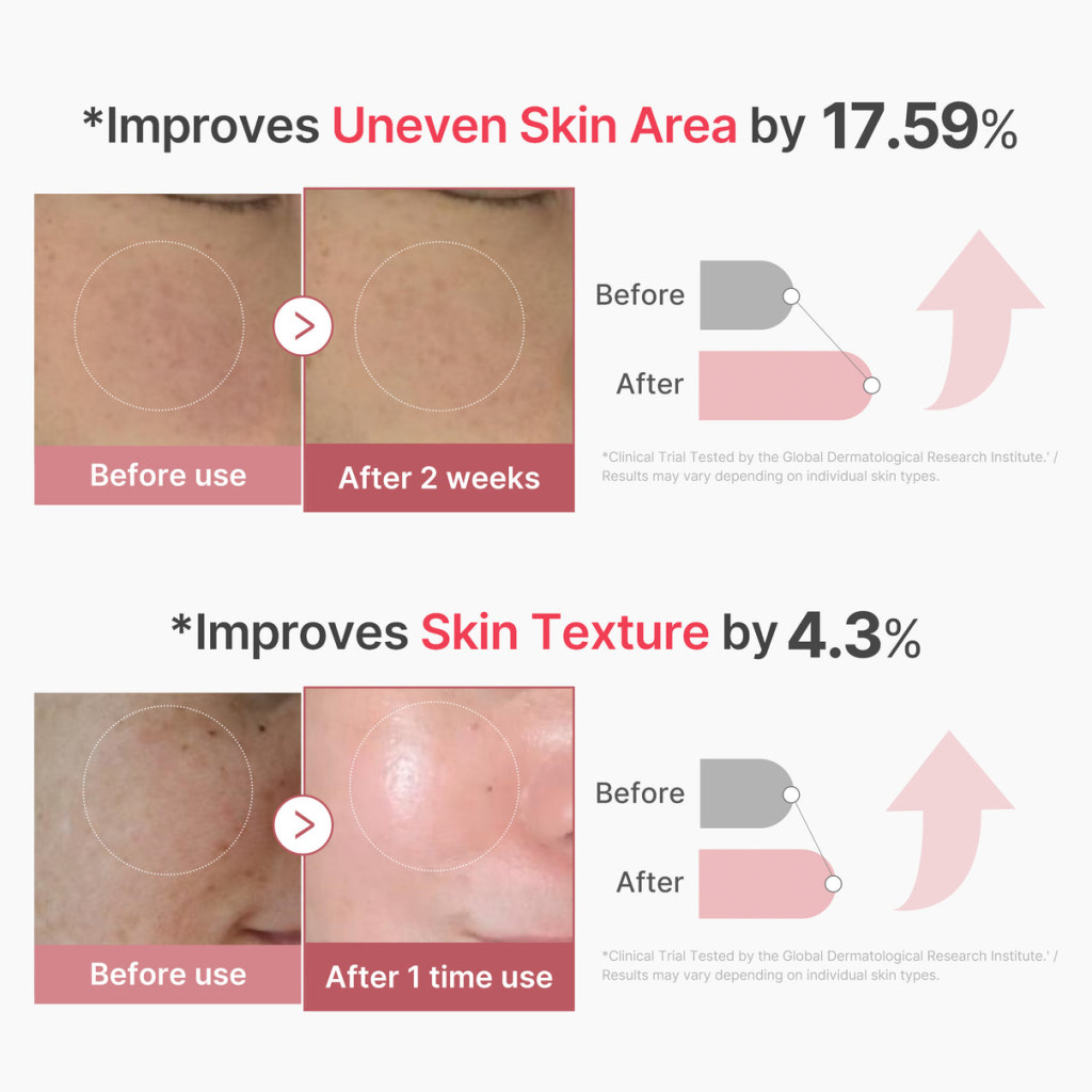 Medicube PDRN Pink Exosome Shot 2000 Serum, Micro-Needling Glow Care with Salmon, 30ml