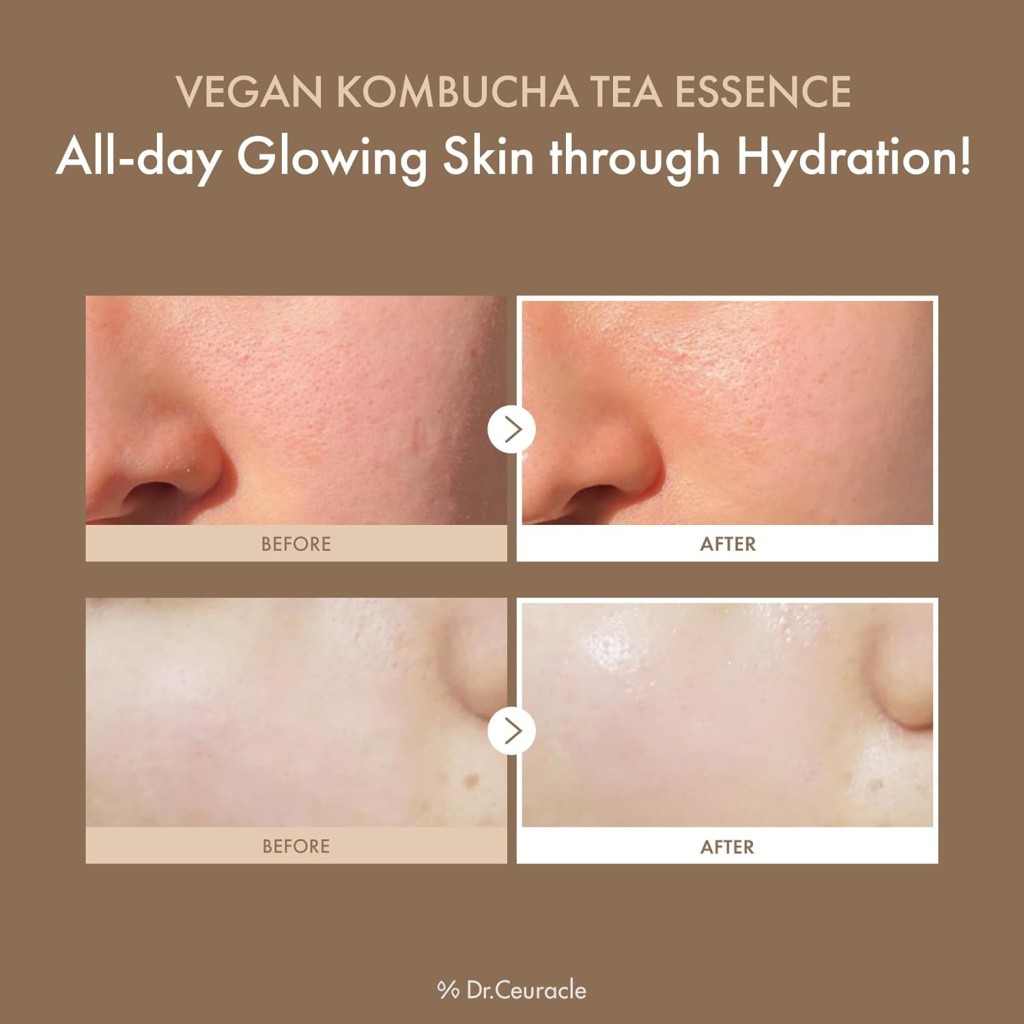 Dr. Ceuracle Vegan Kombucha Tea Essence, Probiotic Hydrating Detox for Glowing Skin, 150ml